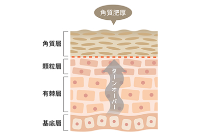 美肌トータルビューティーアドバイザーコース